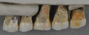 190410-teeth-full