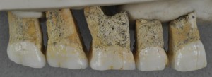 homo-luzonensis-teeth